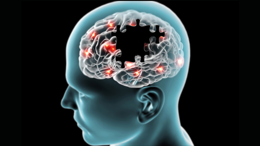 Neurodegenerative Disorders